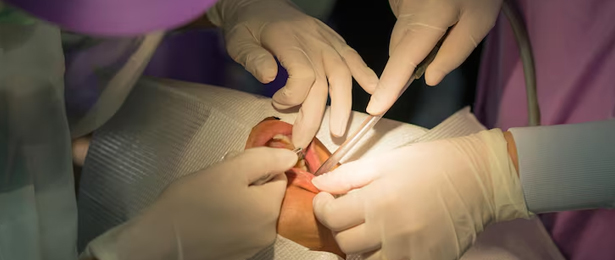 Floor of Mouth & Hard Palate Cancer Surgery