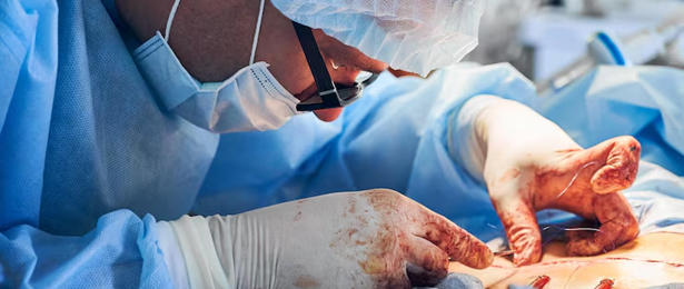 Soft Tissue Sarcoma Surgery
